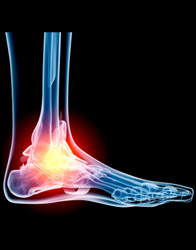 foot and ankle trauma