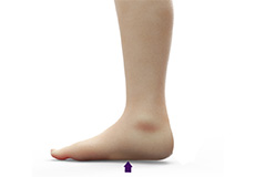 Flat Feet